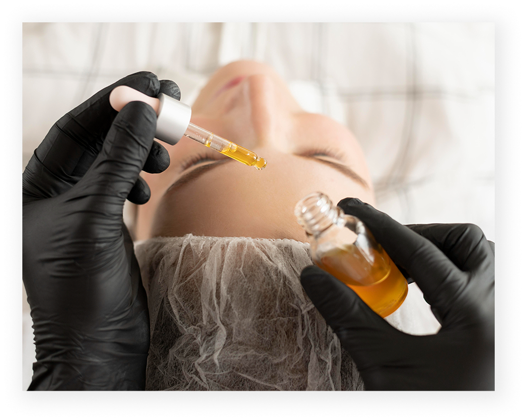Mesotherapy procedure